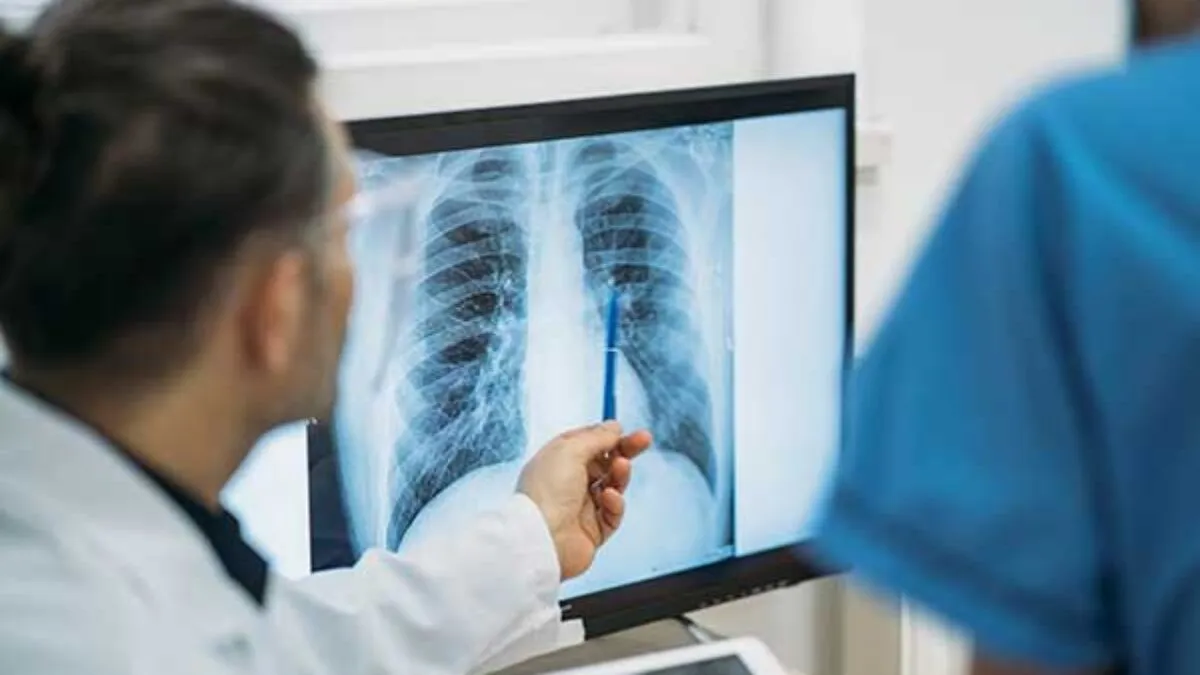 CinfaSalud-fibrosis-pulmonar-idiopatica-600-1200x675-1